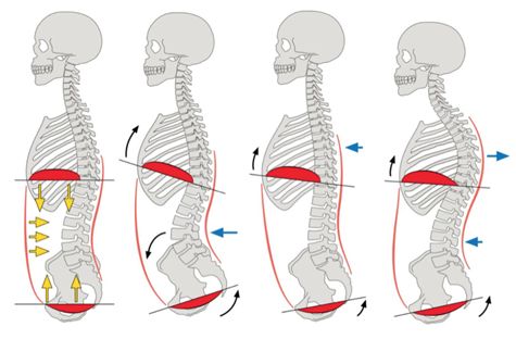 Abdominal Bracing So much more than trying to look thin